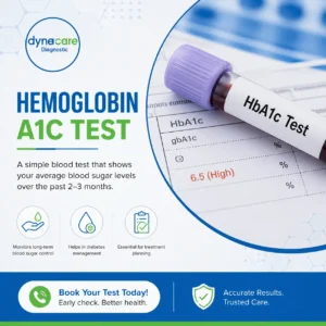 Hemoglobin A1C blood test tube and diabetes screening report at Dynacare Diagnostic -Clovis, CA