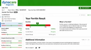 Sample Anemia Test Panel Basic laboratory report showing ferritin, vitamin B12, folate, CBC, and iron test results.