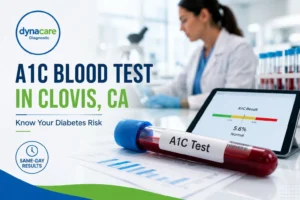 A1C Bolld Test in Clovic, CA -Dynacare Diagnostic